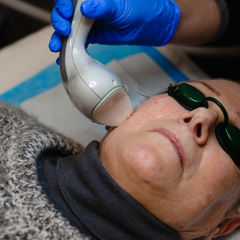 cascade professional services for sun spots and pigmentation cascade professional services for sun spots and pigmentation
