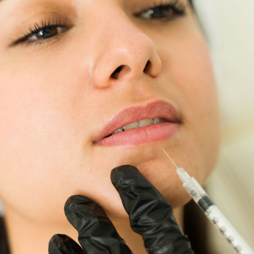 Dermal filler close up Dermal filler close up