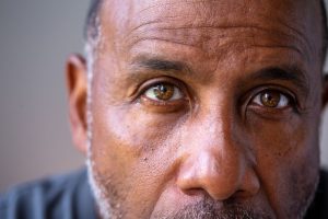 Glaucoma vs Cataracts: Symptoms and Treatments